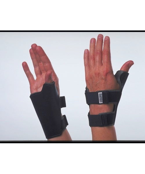 Quad Cuff Gloves